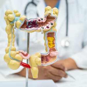 Naturheilkundliche Therapien:</br>Verdauungsbeschwerden Indikationen für Mayr-Kur